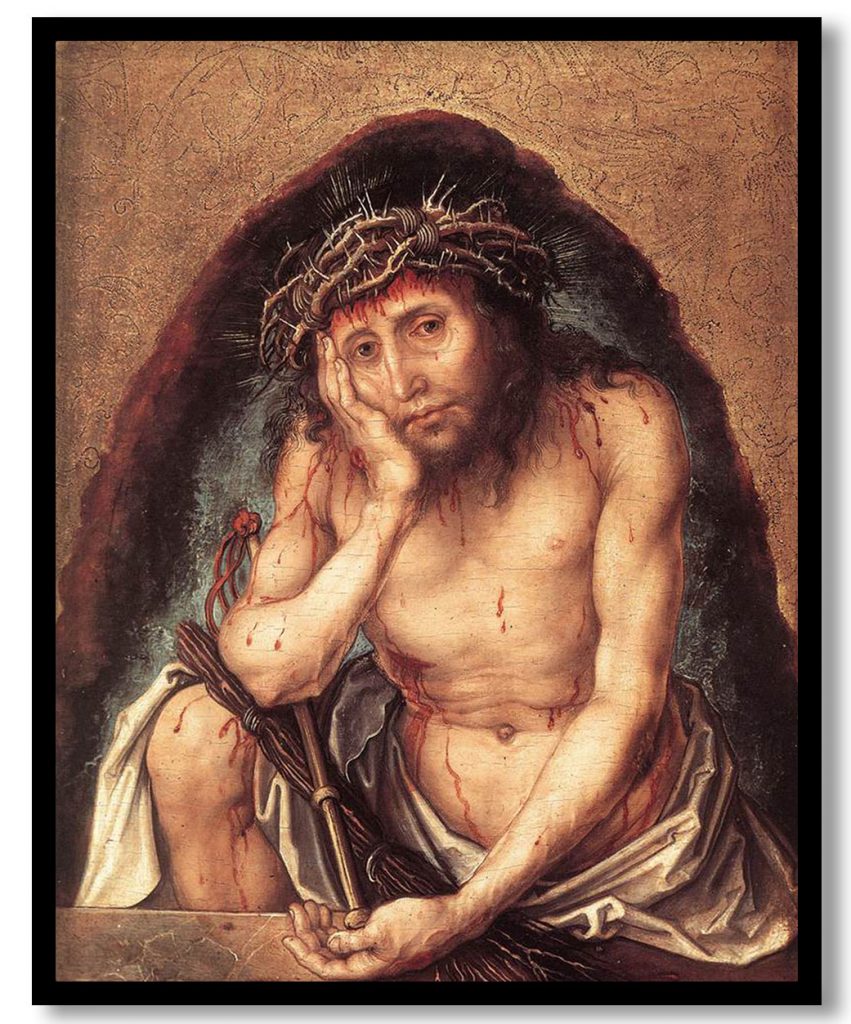 Christ as the Man of Sorrows by Albrecht Durer (1493)